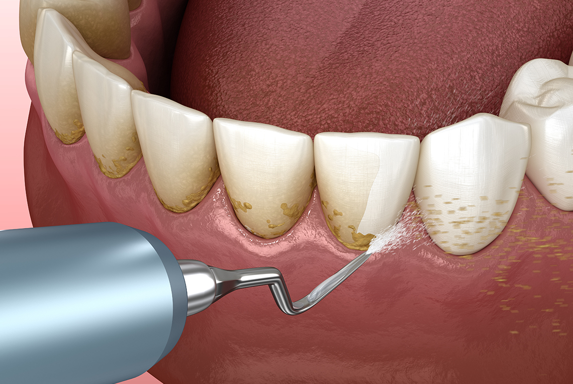 Periodontoloji